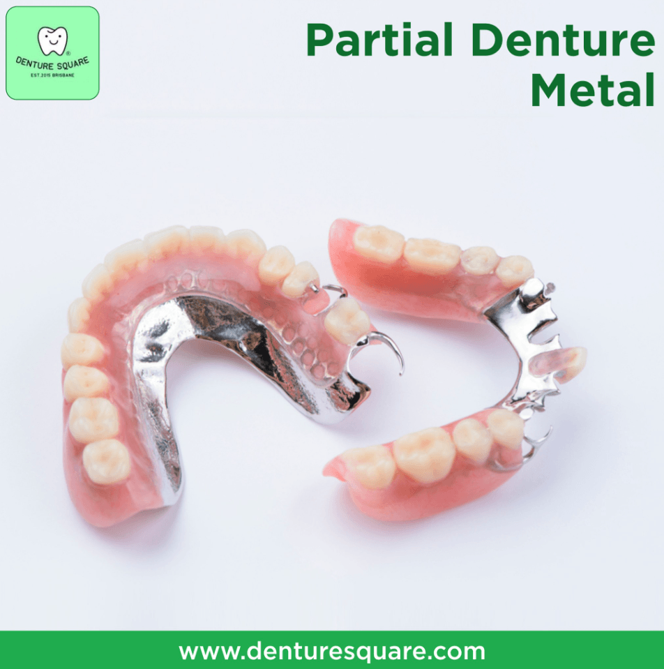 Partial Dentures